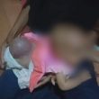 Balita Penderita Spina Bifida di Galela Butuh Biaya Operasi