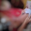 Dinkes Halmahera Barat Rujuk Balita Penderita Tumor ke Surabaya